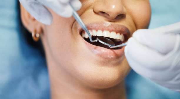 Best Walk-In Emergency Dentist in South Deerfield, MA