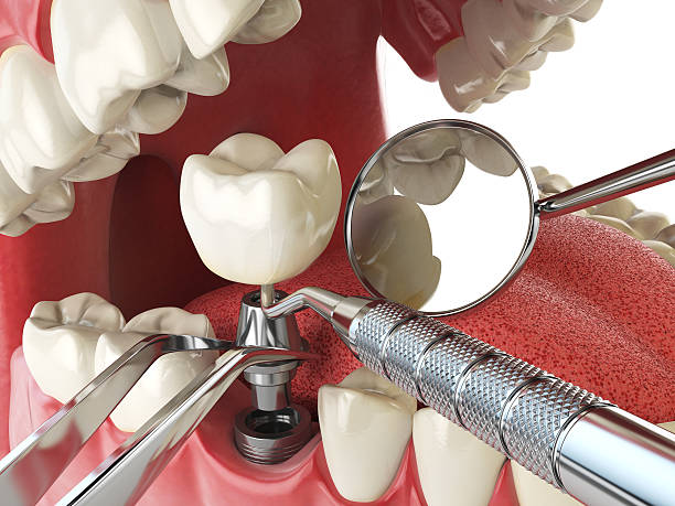 Best Emergency Dental Surgery in South Deerfield, MA